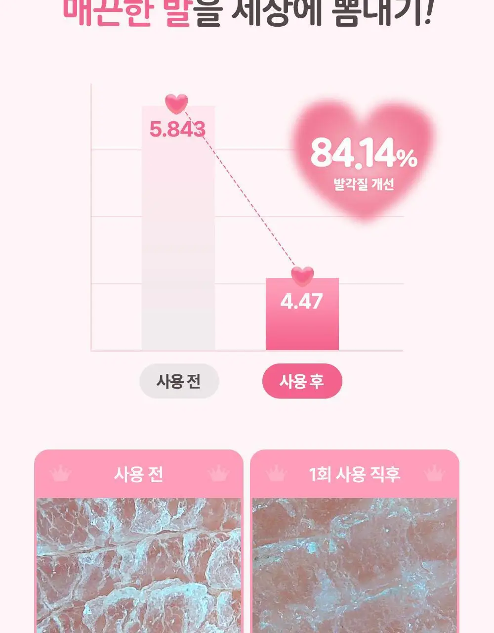 [매끈발템/올인원풋케어] 플루 퍼펙트 발 각질 케어 세트 (발각질 제거기+크림) 상세페이지 21